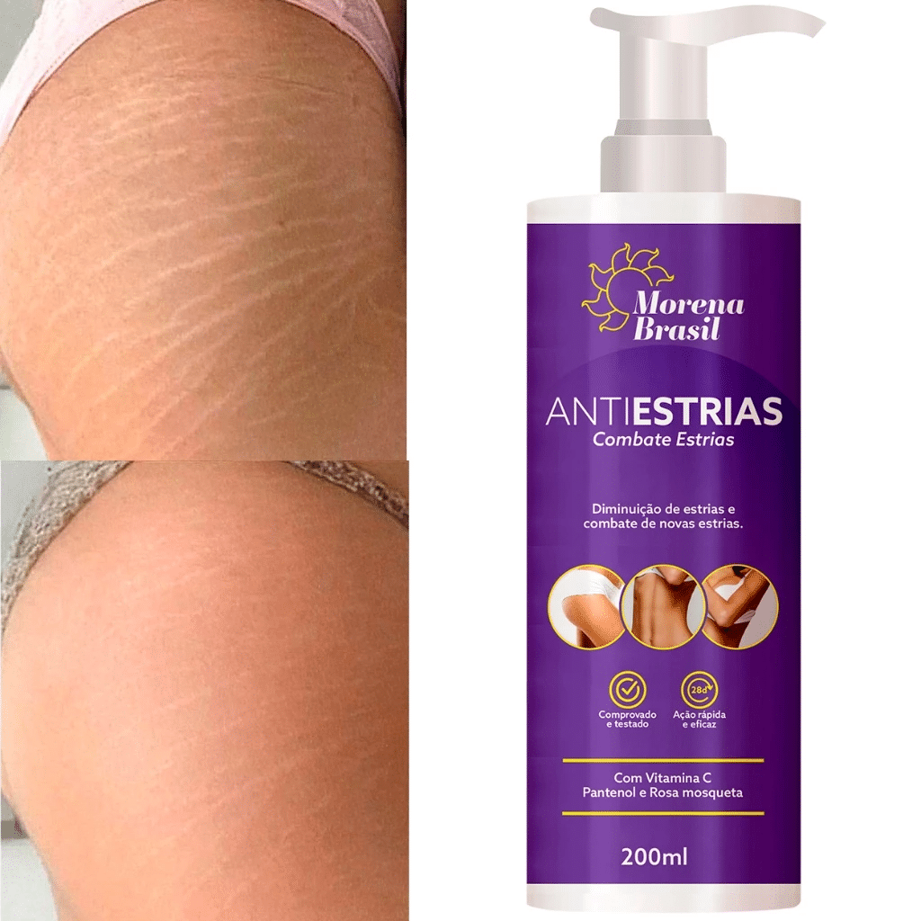 Morena Brasil Creme Anti-Estrias 200g – Elasticidade e Firmeza para sua Pele